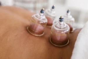 Woman receiving Massage cupping in Florence, Canon City, Manitou Springs