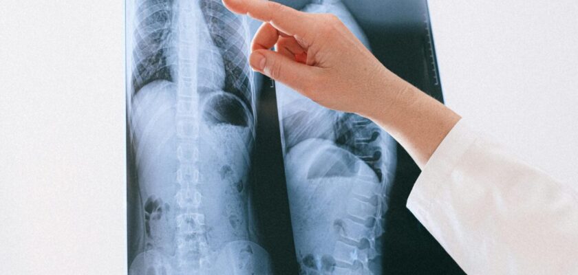 Back Fusion Alternatives: Safer Options You Haven’t Considered