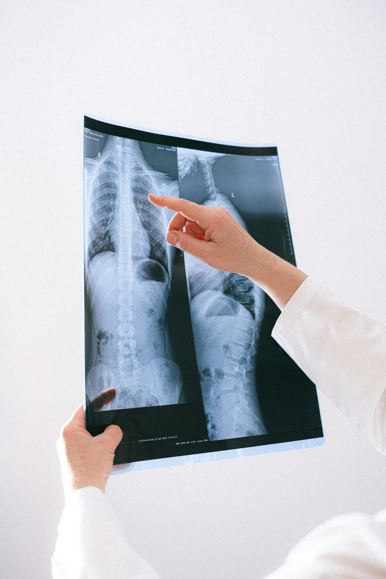 spinal x-ray