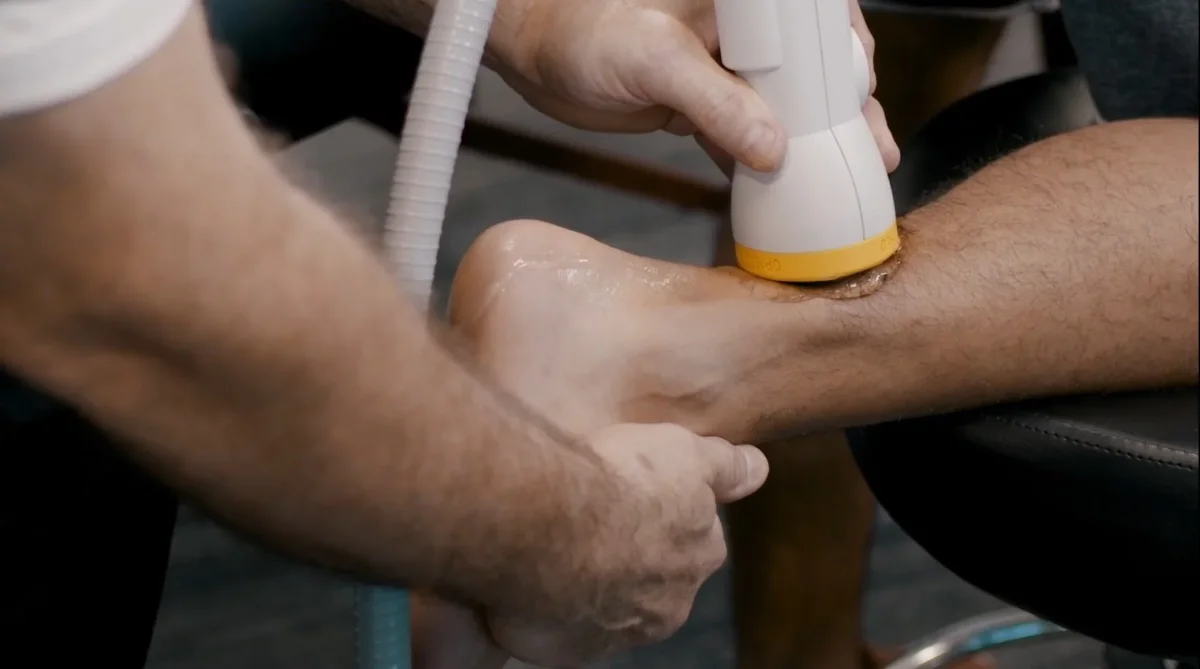 SoftWave Therapy treatment supporting tissue repair and recovery
