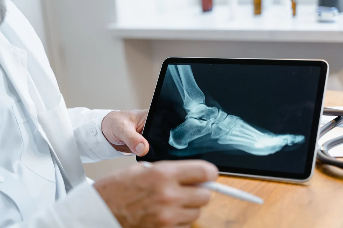 foot xray for pain in Colorado Springs